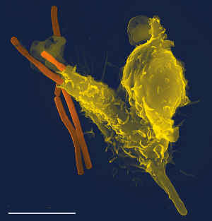 免疫応答。白血球の一種・好中球（黄色）が 炭疽菌（オレンジ）を貪食しているところ。走査型電子顕微鏡写真。